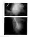 Fig. 63 - Agent for the treatment of alopecia