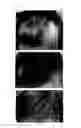Fig. 64 - Agent for the treatment of alopecia