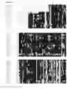 Fig. 04 - ALBUMIN VARIANTS