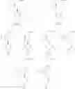 Fig. 10 - Combinations of Eszopiclone and Trans 4-(3,4-Dichlorophenyl)-1,2,3,4-Tetrahydro-N-Methyl-1-Napthalenamine or Trans 4-(3,4-Dichlorophenyl)-1,2,3,4-Tetrahydro-1-Napthalenamine, and Methods of Treatment of Menopause and Mood, Anxiety, and Cognitive Disorders