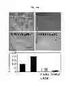 Fig. 04 - Pharmaceutical composition with enhanced efficacy for inhibiting angiogenesis