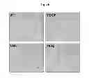 Fig. 05 - Pharmaceutical composition with enhanced efficacy for inhibiting angiogenesis