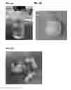 Fig. 07 - Stimuli responsive adhesive gel for removal of foreign particles from soft tissue