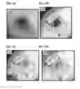 Fig. 09 - Stimuli responsive adhesive gel for removal of foreign particles from soft tissue