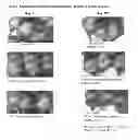 Fig. 02 - ANDROGEN RECEPTOR ANTAGONISTS AND USES THEREOF