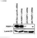 Fig. 09 - PARP-1 INHIBITORS