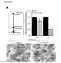 Fig. 30 - PARP-1 INHIBITORS