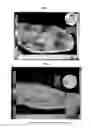 Fig. 02 - COMPOSITION FOR TREATMENT OF EPITHELIAL TISSUE