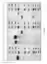 Fig. 03 - Method of increasing the hydrodynamic volume of polypeptides by attaching to gonadotrophin carboxy terminal peptides
