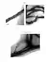 Fig. 03 - Method of preparing carbon nanotube composite surface having metal particles