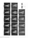Fig. 06 - Antibodies to TIP-1