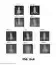 Fig. 40 - Antibodies to TIP-1