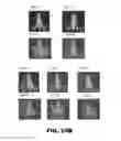 Fig. 41 - Antibodies to TIP-1