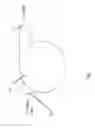 Fig. 02 - Graft for use with counterpulsation device