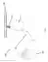 Fig. 03 - Graft for use with counterpulsation device