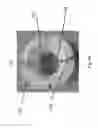 Fig. 06 - Graft for use with counterpulsation device