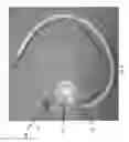 Fig. 08 - Graft for use with counterpulsation device