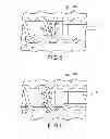 Fig. 05 - Insertion apparatus