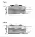 Fig. 02 - Apparatus for electrodermal activity measurement with current compensation