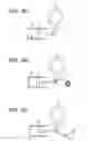 Fig. 09 - Non-contact tonometer, control method of the same, and program