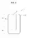 Fig. 03 - Radial cardiac catheterization board