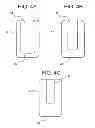 Fig. 05 - Radial cardiac catheterization board