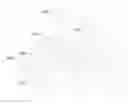 Fig. 01 - NEEDLE POSITIONING APPARATUS AND METHOD