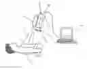 Fig. 01 - PREOPERATIVE IDENTIFICATION OF PERFORATOR VESSELS IN FLAPS TO BE USED IN RECONSTRUCTIVE SURGERY