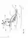 Fig. 07 - Vial-mounted micro vein enhancer