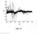 Fig. 11 - Detection apparatus for determining a state of tissue