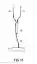 Fig. 19 - Detection apparatus for determining a state of tissue