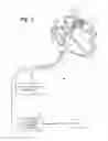 Fig. 02 - METHOD AND APPARATUS FOR SUPPRESSING FAR-FIELD SENSING DURING ATRIAL MAPPING