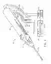 Fig. 02 - Biopsy device
