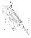 Fig. 03 - Biopsy device