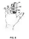 Fig. 08 - MOBILIZING MUSCULOSKELETAL STRUCTURES