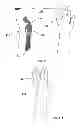 Fig. 11 - MOBILIZING MUSCULOSKELETAL STRUCTURES