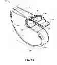 Fig. 12 - MOBILIZING MUSCULOSKELETAL STRUCTURES