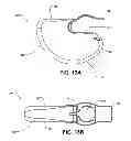 Fig. 13 - MOBILIZING MUSCULOSKELETAL STRUCTURES
