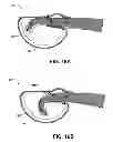 Fig. 16 - MOBILIZING MUSCULOSKELETAL STRUCTURES