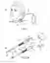 Fig. 02 - Continuous anesthesia nerve conduction apparatus, system and method thereof