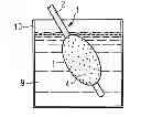 Fig. 01 - Method for producing a bioactive surface on an endoprosthesis or on the balloon of a balloon catheter