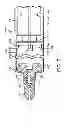 Fig. 06 - AUTO-DISABLE SAFETY SYRINGE