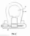 Fig. 04 - Catheter securement device