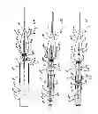 Fig. 06 - Needle for bloodless IV
