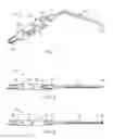 Fig. 02 - Noise-suppressing, suction probe apparatus and method