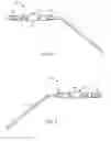 Fig. 03 - Noise-suppressing, suction probe apparatus and method