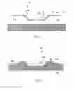 Fig. 02 - Convex supporting device