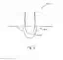 Fig. 04 - Convex supporting device
