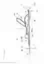 Fig. 04 - Catheter Clip