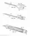 Fig. 07 - Reduced pressure augmentation of microfracture procedures for cartilage repair
